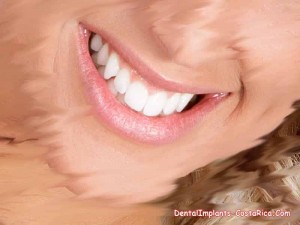 Smile Designing in Costa Rica