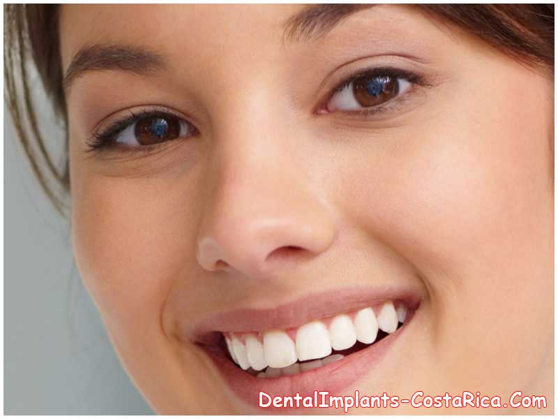 False Teeth Pegs in Costa Rica | Dental Implants in Costa Rica
