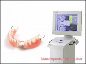 cad-cam-crowns