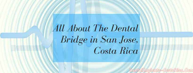 Dental Bridges in Costa Rica