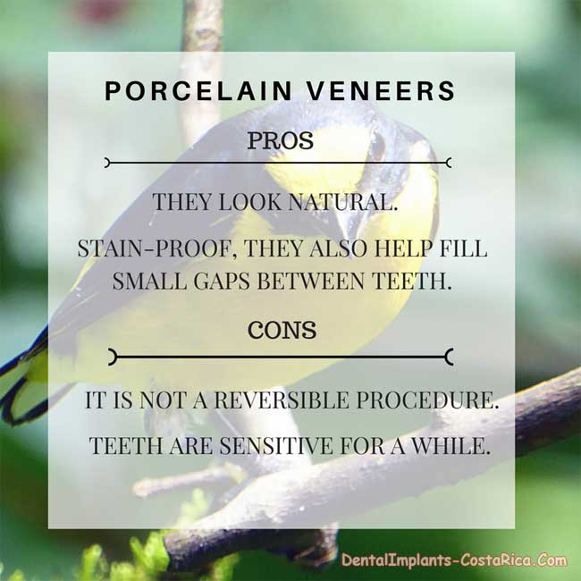 Dental Veneers Pros and Cons