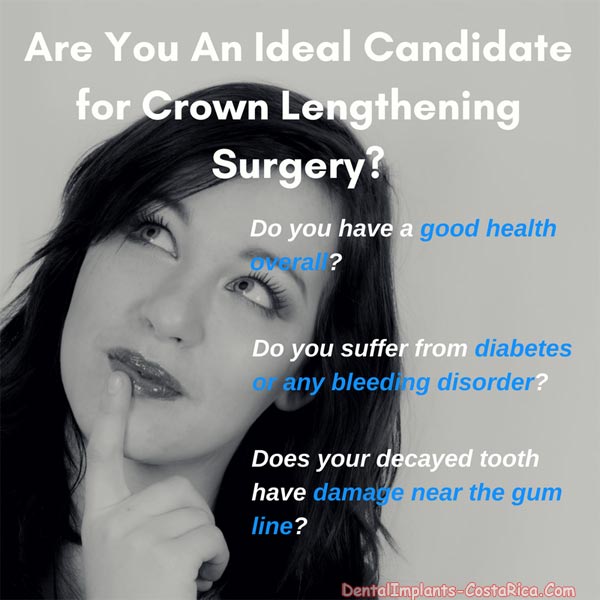 ideal-candidate-for crown-lengthening
