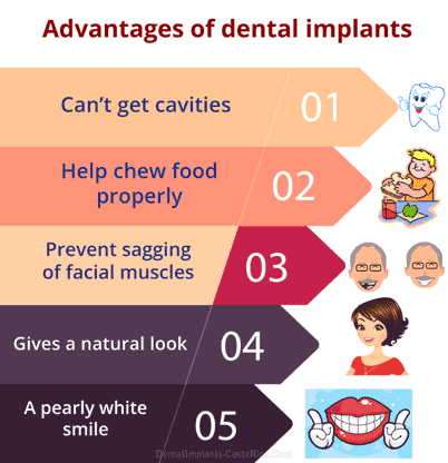 benefits-of-dental-implants