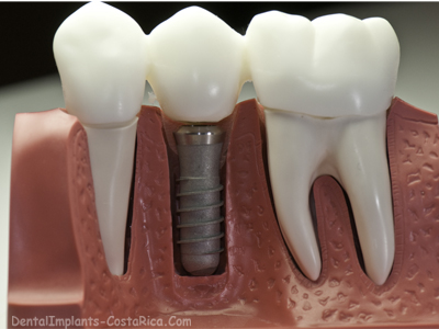 dental-surgery-in-costa-rica